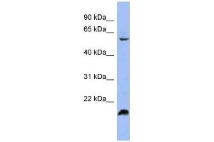 WB Suggested Anti-SFRS4 Antibody Titration: 0.