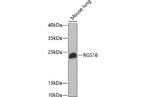 Western blot analysis of extracts of mouse lung, using RGS16 antibody (ABIN1682525, ABIN3018505, ABIN3018506 and ABIN6220488) at 1:1000 dilution.