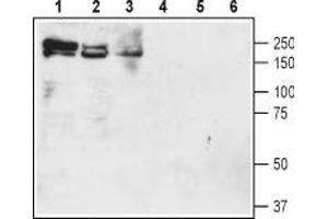 Western blot analysis of rat brain membranes (lanes 1 and 4), mouse brain membranes (lanes 2 and 5) and rat lung lysate (lanes 3 and 6):1-3. (Solute Carrier Family 12 (Potassium-Chloride Transporter) Member 2 (SLC12A2) Peptide)