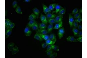 Immunofluorescence staining of Hela cells with ABIN7127705 at 1:100,counter-stained with DAPI.