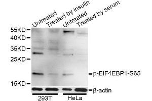 Western blot analysis of extracts of 293T and HeLa cells, using Phospho-EIF4EBP1-S65 antibody (ABIN5969889) at 1/1000 dilution. (eIF4EBP1 anticorps  (pSer65))
