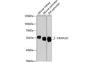 Western blot analysis of extracts of various cell lines using CRISPLD2 Polyclonal Antibody at dilution of 1:3000.