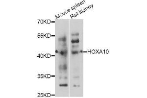 Western blot analysis of extracts of various cell lines, using HOXA10 antibody (ABIN5995981) at 1/1000 dilution. (HOXA10 anticorps)