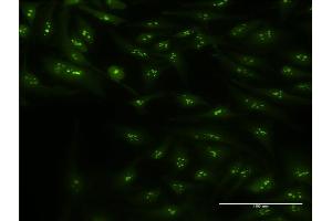 Immunofluorescence of monoclonal antibody to CIRBP on HeLa cell.