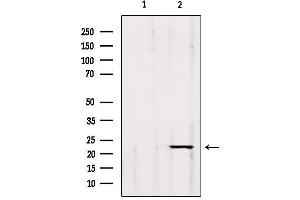 Western blot analysis of extracts from hybridoma cells, using GP1BB Antibody. (GP1BB anticorps)