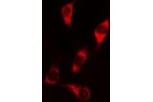 ABIN6269287 staining HeLa? (Caspase 9 anticorps  (Internal Region))