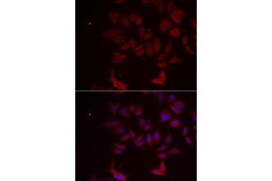 Immunofluorescence analysis of MCF-7 cell using RPL11 antibody.