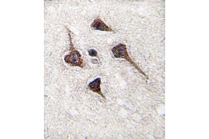 Formalin-fixed and paraffin-embedded human brain tissue reacted with CAMK2A (C-term E370) , which was peroxidase-conjugated to the secondary antibody, followed by DAB staining. (CAMK2A anticorps  (C-Term))