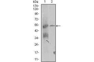 Western blot analysis using TRIP6 mouse mAb against K562 and A431 (2) cell lysate. (TRIP6 anticorps  (AA 107-291))