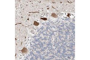 Immunohistochemical staining of human cerebellum with STARD9 polyclonal antibody  shows strong cytoplasmic positivity in purkinje cells. (STARD9 anticorps)