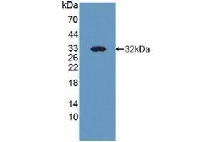Detection of Recombinant NID2, Human using Polyclonal Antibody to Nidogen 2 (NID2) (NID2 anticorps  (AA 31-289))