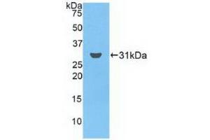 Western blot analysis of recombinant Human FCN3. (FCN3 anticorps  (AA 34-297))