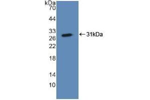 Western blot analysis of recombinant Human ASGR1. (Asialoglycoprotein Receptor 1 anticorps  (AA 77-289))