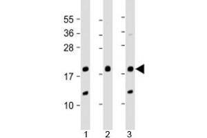 Western blot testing of human 1) A431, 2) SK-BR-3 and 3) U-2OS cell lysate with THRSP antibody at 1:2000. (THRSP anticorps  (AA 18-48))