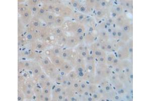 IHC-P analysis of Human Tissue, with DAB staining. (Catalase anticorps  (AA 32-167))