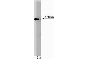 Western blot analysis of Smad2/3 on Jurkat cell lysate. (Smad2/3 anticorps  (AA 142-263))