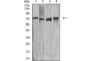 Western Blotting (WB) image for anti-Matrix Metalloproteinase 2 (MMP2) (AA 9-140) antibody (ABIN5885252) (MMP2 anticorps  (AA 9-140))