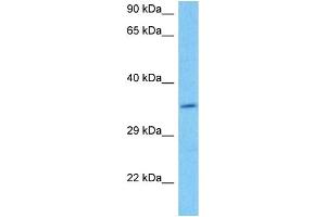 Host:  Mouse  Target Name:  DAZL  Sample Tissue:  Mouse Brain  Antibody Dilution:  1ug/ml (DAZL anticorps  (C-Term))