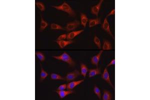 Immunofluorescence analysis of NIH/3T3 cells using FAK Rabbit pAb (ABIN6134667, ABIN6146423, ABIN6146425 and ABIN6215105) at dilution of 1:100 (40x lens).