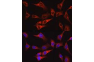 Immunofluorescence analysis of NIH/3T3 cells using FAK Rabbit pAb (ABIN6134667, ABIN6146423, ABIN6146425 and ABIN6215105) at dilution of 1:100 (40x lens). (FAK anticorps  (AA 700-800))