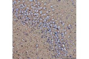 IHC analysis of CD90/Thy1 using anti-CD90/Thy1 antibody (ABIN5518877). (CD90 anticorps  (AA 20-131))