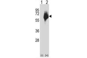 Western blot analysis of MMP2 antibody and 293 cell lysate either nontransfected (Lane 1) or transiently transfected (2) with the MMP2 gene.