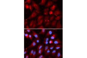Immunofluorescence analysis of U2OS cells using PSMB2 antibody (ABIN5973193).