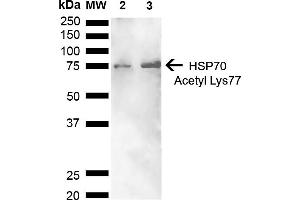 Western blot analysis of Human Cervical cancer cell line (HeLa) lysate showing detection of ~70 kDa HSP70 Acetyl Lys77 protein using Rabbit Anti-HSP70 Acetyl Lys77 Polyclonal Antibody (ABIN5650761).