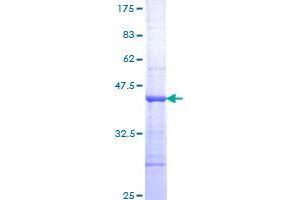 Image no. 1 for TNNI3 Interacting Kinase (TNNI3K) (AA 371-470) protein (GST tag) (ABIN1323288)