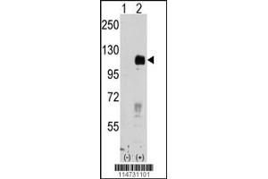 Western blot analysis of EphB4 using rabbit polyclonal EphB4 Antibody. (EPH Receptor B4 anticorps)