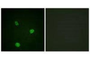 Immunofluorescence analysis of HeLa cells, using MITF (Ab-180/73) antibody. (MITF anticorps  (Ser73, Ser180))