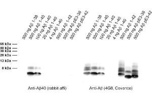 Detection of synthetic Abeta 1-38, 1-40 and 1-42 with anti-Abeta 40 (dilution 1 : 1000) and a commercially available monoclonal anti-Abeta antibody.