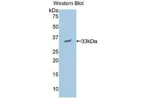 Western Blotting (WB) image for anti-Signal Transducer and Activator of Transcription 1, 91kDa (STAT1) (AA 432-680) antibody (ABIN3206142) (STAT1 anticorps  (AA 432-680))