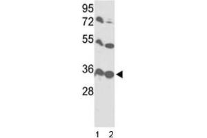 Western blot analysis of VDAC1 antibody and 1) HL-60 and 2) Y79 lysate.
