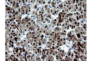 Image no. 1 for anti-Cytidine Monophosphate (UMP-CMP) Kinase 1, Cytosolic (CMPK1) antibody (ABIN1497542)