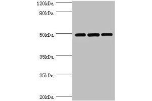 Western blot All lanes: m7GpppN-mRNA hydrolase antibody at 7 μg/mL Lane 1: Hela whole cell lysate Lane 2: Jurkat whole cell lysate Lane 3: 293T whole cell lysate Secondary Goat polyclonal to rabbit IgG at 1/10000 dilution Predicted band size: 49, 45 kDa Observed band size: 49 kDa