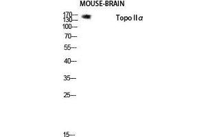 Western Blot (WB) analysis of Mouse Brain lysis using Topo IIalpha antibody. (Topo IIalpha (Tyr174) anticorps)