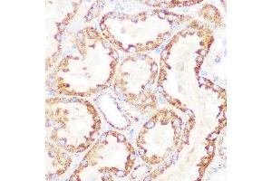Immunohistochemistry of paraffin-embedded rat kidney using DLDH/DLD Rabbit mAb (ABIN7266766) at dilution of 1:100 (40x lens). (DLD anticorps)