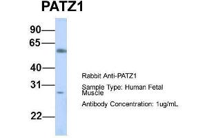 Host:  Rabbit  Target Name:  PATZ1  Sample Type:  Human Fetal Muscle  Antibody Dilution:  1. (PATZ1 anticorps  (N-Term))
