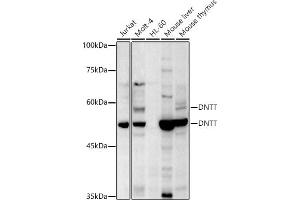Western blot analysis of extracts of various cell lines, using TdT antibody (ABIN6130878, ABIN6139759, ABIN6139760 and ABIN6221856) at 1:500 dilution. (TdT anticorps  (AA 260-509))