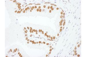 Immunohistochemistry (IHC) image for anti-Heterogeneous Nuclear Ribonucleoprotein L (HNRNPL) (C-Term) antibody (ABIN7795592) (HNRNPL anticorps  (C-Term))