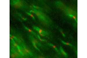 (Closeup) Adult rat optic nerve immunofluorescence staining K87A/10=red Rabbit anti-Caspr=green Image courtesy of Dr.