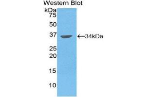 Western Blotting (WB) image for anti-Matrix Metallopeptidase 7 (Matrilysin, Uterine) (MMP7) (AA 1-267) antibody (ABIN1859858) (MMP7 anticorps  (AA 1-267))