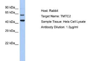 Host: Rabbit Target Name: TMTC2 Sample Type: Hela Whole cell lysates Antibody Dilution: 1. (TMTC2 anticorps  (C-Term))