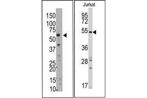 Image no. 1 for anti-SMYD Family Member 5 (SMYD5) (C-Term) antibody (ABIN358724)