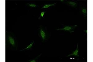 Immunofluorescence of monoclonal antibody to CDR2 on HeLa cell. (CDR2 anticorps  (AA 296-404))