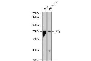 Western blot analysis of extracts of various cell lines using KRT2 Polyclonal Antibody at dilution of 1:1000. (Keratin 2 anticorps)