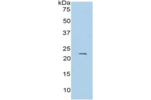 WB of Protein Standard: different control antibodies  against Highly purified E.
