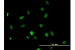 Immunofluorescence of monoclonal antibody to HDAC1 on HeLa cell. (HDAC1 anticorps  (AA 1-482))