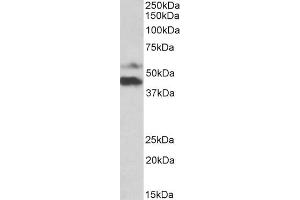 ABIN5539924 (1µg/ml) staining of Human Colorectal Cancer lysate (35µg protein in RIPA buffer). (PYROXD1 anticorps  (N-Term))